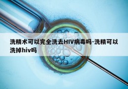 洗精术可以完全洗去HIV病毒吗-洗精可以洗掉hiv吗