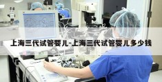 上海三代试管婴儿-上海三代试管婴儿多少钱