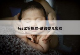 les试管原理-试管婴儿实验