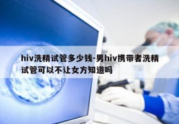 hiv洗精试管多少钱-男hiv携带者洗精试管可以不让女方知道吗