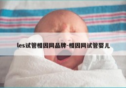 les试管相因网品牌-相因网试管婴儿