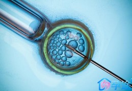 试管婴儿助孕中为什么要做宫腔镜