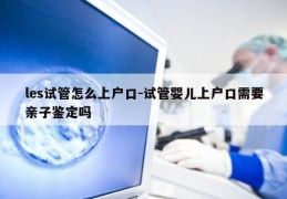 les试管怎么上户口-试管婴儿上户口需要亲子鉴定吗