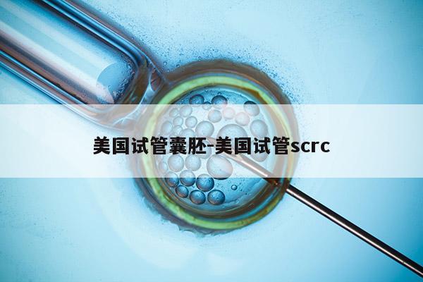 美国试管囊胚-美国试管scrc