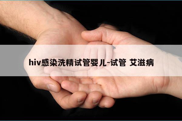 hiv感染洗精试管婴儿-试管 艾滋病