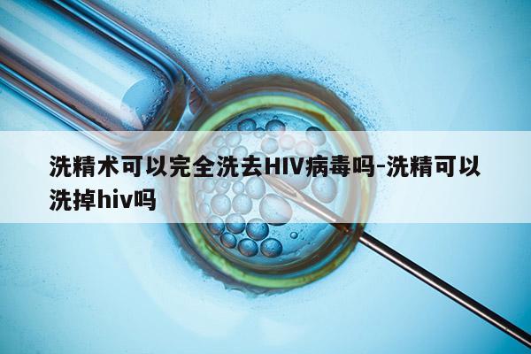 洗精术可以完全洗去HIV病毒吗-洗精可以洗掉hiv吗