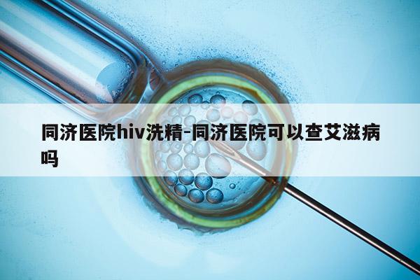 同济医院hiv洗精-同济医院可以查艾滋病吗