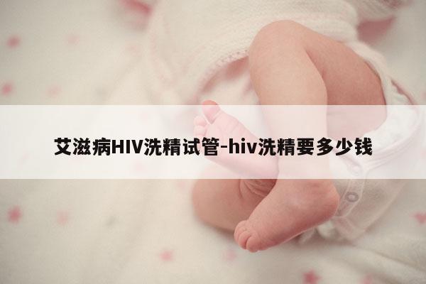 艾滋病HIV洗精试管-hiv洗精要多少钱